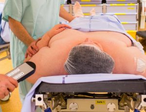 Endoscopiques les autres traitements pour l'obésité